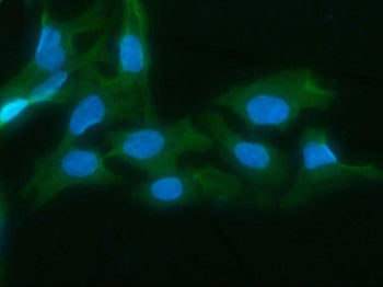 AKR1D1 Antibody