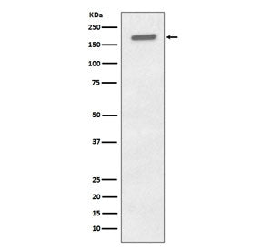 Phospho-EGF Receptor / EGFR Antibody (pY1173)
