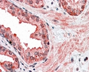 CCNDBP1 Antibody