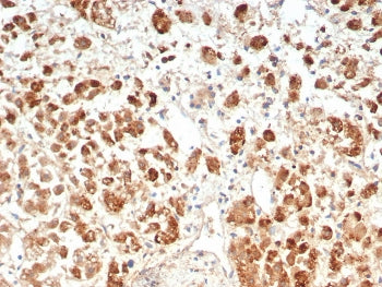 IL18R1 Antibody / Interleukin 18 receptor alpha