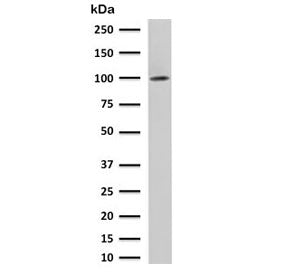 Folate Hydrolase 1 Antibody / FOLH1 / PSMA