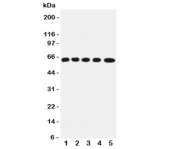 Western blot testing of OCTN2 antibody and Lane 1: rat kidney; 2: (r) skeletal muscles; 3: mouse liv