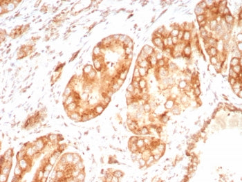 IHC staining of FFPE human brain tissue with Osteopontin antibody (clone OSP/8693R). HIER: boil tiss