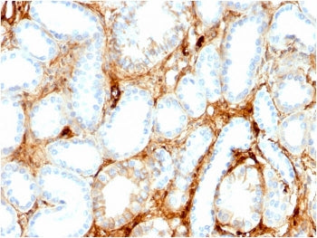 IHC staining of FFPE human kidney with FABP1 antibody. HIER: boil tissue sections in pH 9 10mM Tris 