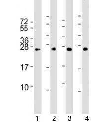 RAB5B Antibody