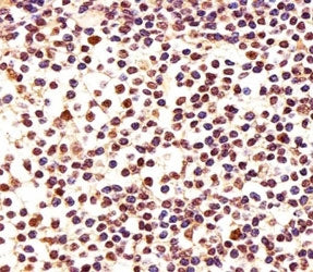 PCNA Antibody (Proliferating Cell Nuclear Antigen)