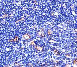 Integrin beta 2 Antibody (ITGB2)