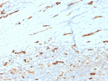 IHC staining of FFPE human tonsil tissue with PECAM1 antibody (clone PECAM1/3534). HIER: boil tissue