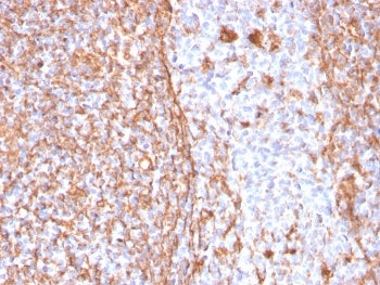IHC staining of FFPE human tonsil with recombinant Vimentin antibody (clone VIM/1937R). HIER: boil t