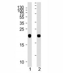 NRAS antibody western blot analysis in 1) human A431 and 2) rat C6 lysate. Predicted molecular weigh