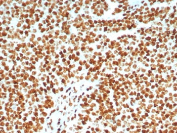 Ku80 Antibody / XRCC5
