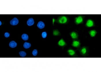 TBP-1 Antibody / PSMC3