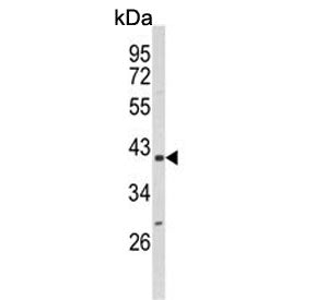 Western blot testing of mouse NIH 3T3 cell lysate with PPIase D antibody. Predicted molecular weight