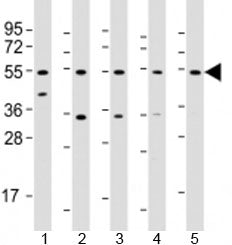 THRB Antibody / Thyroid hormone receptor beta