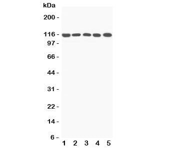 Western blot testing of C5A antibody and Lane 1: rat liver; 2: mouse liver; 3: (m) NIH3T3; 4: (m) HEPA1-6; 5: (r) PC12 lysate; Predicted molecular weight ~115 kDa.