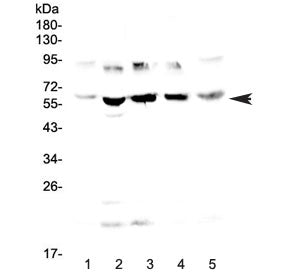 Steroid sulfatase Antibody