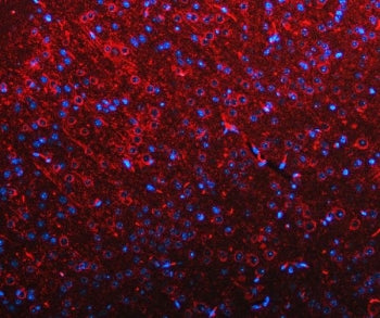 Immunofluorescent staining of FFPE mouse brain tissue with RIMS-binding protein 2 antibody (red) and