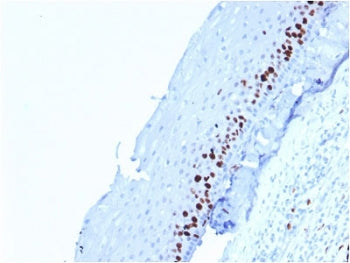 Ki67 Antibody