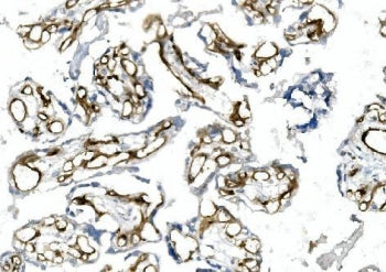 CD146 Antibody / MCAM / MUC18