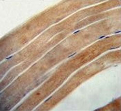 EFL1 Antibody / EFTUD1