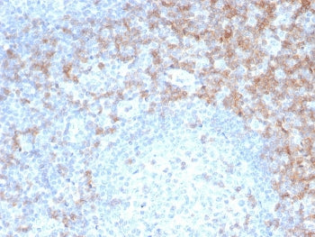 IHC staining of FFPE human tonsil tissue with recombinant CD5 antibody (clone rC5/6462). HIER: boil 