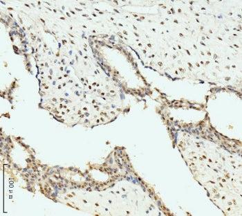 AKAP8 Antibody / AKAP 95