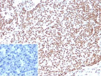 IHC staining of FFPE human lymph node tissue with E2F4 antibody (clone E2F4/4224). Inset: PBS used i