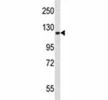 Epha2 Antibody