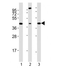 Western blot testing of Sox17 antibody at 1:2000 dilution. Lane 1: mouse F9 lysate; 2: human LNCaP l