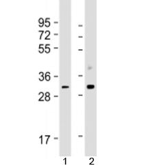 Western blot testing of human 1) Jurkat and 2) HeLa cell lysate with CDK1 antibody at 1:1000. Predic