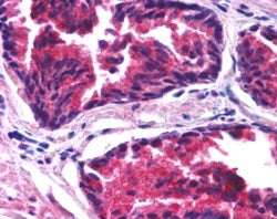 IHC testing of FFPE human prostate with SNX26 antibody at 1.25ug/ml. HIER: steamed with pH6 citrate 