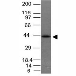 Western blot of HCT116 cell lysate using EpCAM antibody (EGP40/837). Expected molecular weight: ~35 