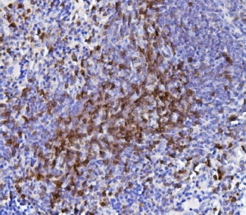 Cd5 Antibody