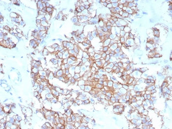 HER2 Antibody / ErbB2