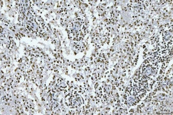 IHC staining of FFPE human spleen tissue with GADD45B antibody. HIER: boil tissue sections in pH8 ED