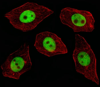 GTF2I Antibody / TFII-I