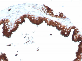 IHC staining of FFPE human prostate tissue with CD63 antibody (clone LAMP3/8770R). HIER: boil tissue