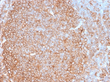 Pan-HLA Antibody (MHC II)