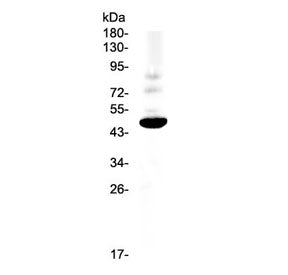 CCR1 Antibody