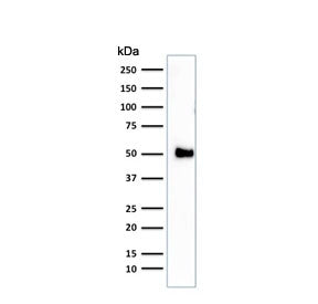 Western blot testing of human Jurkat cell lysate with CD2 antibody (clone 1E7E8.G4). Expected molecu