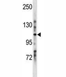 LRIG1 Antibody
