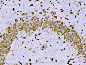 BRSK1 Antibody / Brain-selective kinase 1