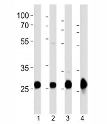 Western blot analysis of lysate from mouse 1) heart, 2) liver, 3) rat heart, 4) zebrafish heart tiss
