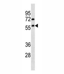 TRIM13 Antibody