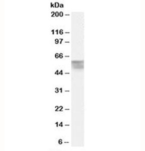 Western blot testing of human bone marrow lysate with Thyroid hormone receptor alpha antibody at 0.5