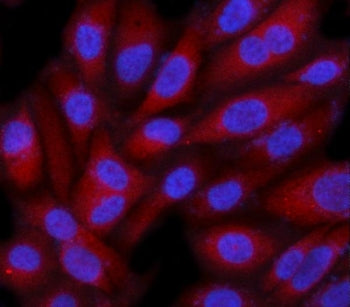 Immunofluorescent staining of FFPE human PC-3 cells with SMG9 antibody (red) and DAPI nuclear stain 