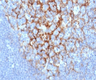 IHC staining of FFPE human lymph node with CD23 antibody (clone FCER2/6892) at 2ug/ml in PBS for 30m