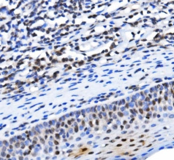 TBP associated factor 4 Antibody / TAF4