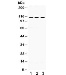 UNC5C Antibody