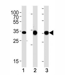 CCND1 antibody western blot analysis in (1) human A431, (2) mouse L929 and (3) rat C6 lysate. Predic